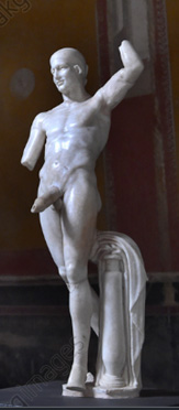 Priapism