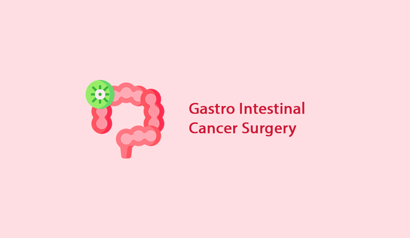 Gastrointestinal Cancer Surgery in Ambur - KM NU Hospitals
