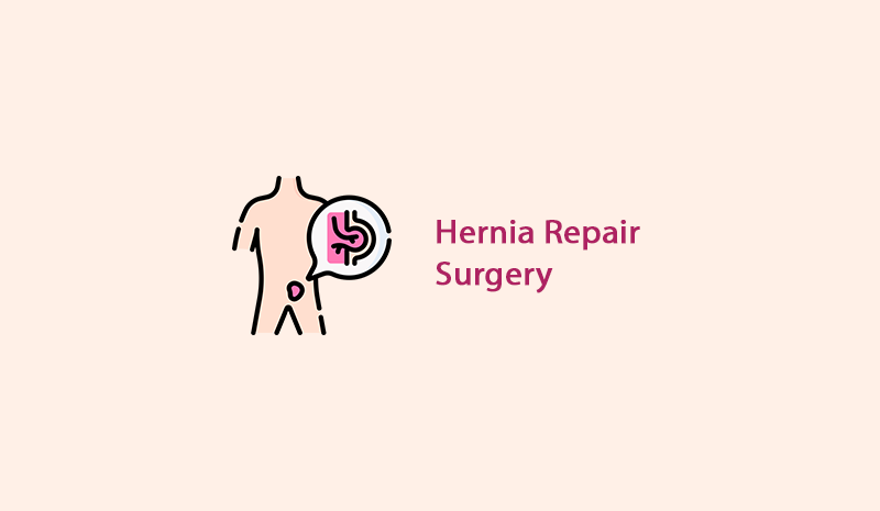 Hernia Repair Surgery in Ambur - KM NU Hospitals