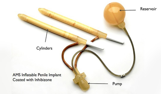 penile Implant